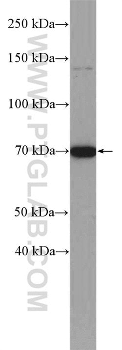 GALNT3 Rabbit anti-Human, Mouse, Rat, Polyclonal, Proteintech:Antibodies:Primary