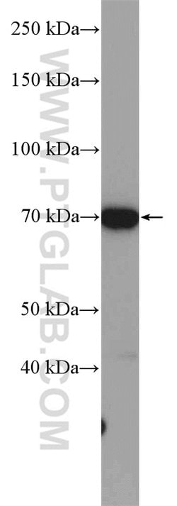 GALNT3 Rabbit anti-Human, Mouse, Rat, Polyclonal, Proteintech:Antibodies:Primary