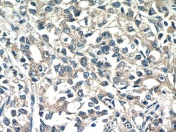 TMEM71 Rabbit anti-Human, Polyclonal, Proteintech 150 &mu;L; Unconjugated:Antibodies,