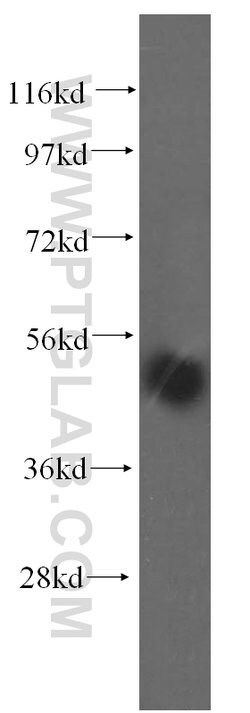 TASP1 Rabbit anti-Human, Mouse, Rat, Polyclonal, Proteintech 20 &mu;L;