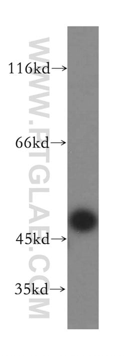 TASP1 Rabbit anti-Human, Mouse, Rat, Polyclonal, Proteintech 20 &mu;L;