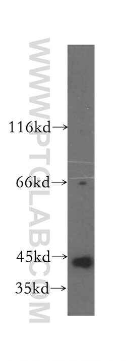 PHKG1 Rabbit anti-Human, Mouse, Rat, Polyclonal, Proteintech 20 &mu;L;