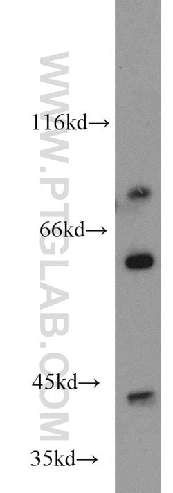 PHKG1 Rabbit anti-Human, Mouse, Rat, Polyclonal, Proteintech 20 &mu;L;