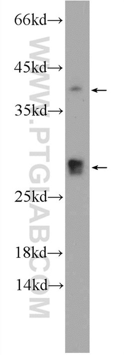 CENPN Rabbit anti-Human, Mouse, Rat, Polyclonal, Proteintech:Antibodies:Primary