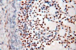 FOXP4 Rabbit anti-Human, Mouse, Rat, Polyclonal, Proteintech 150 &mu;L;