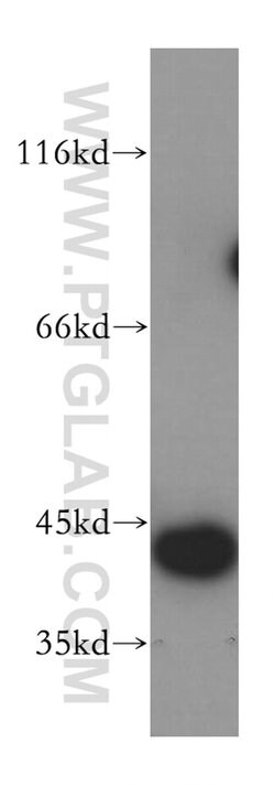 DNAJB12 Rabbit anti-Human, Mouse, Rat, Polyclonal, Proteintech:Antibodies:Primary