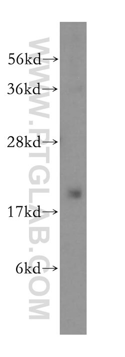 DCTD Rabbit anti-Human, Mouse, Rat, Polyclonal, Proteintech 150 &mu;L | Buy Online | Proteintech Group Inc | Fisher Scientific