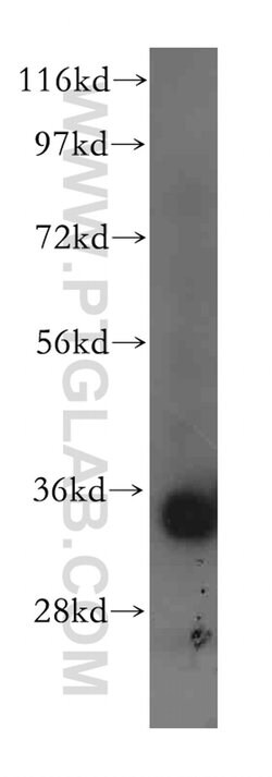 ACY3 Rabbit anti-Human, Mouse, Rat, Polyclonal, Proteintech:Antibodies:Primary