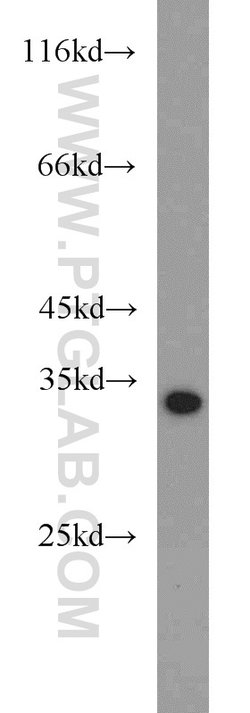 ACY3 Rabbit anti-Human, Mouse, Rat, Polyclonal, Proteintech:Antibodies:Primary