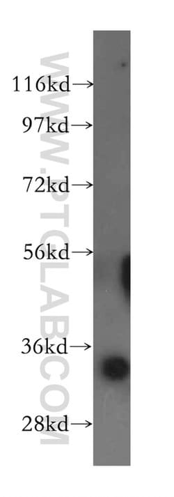 GLOD4 Rabbit anti-Human, Mouse, Rat, Polyclonal, Proteintech 150 &mu;L;