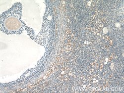 GLOD4 Rabbit anti-Human, Mouse, Rat, Polyclonal, Proteintech 150 &mu;L;