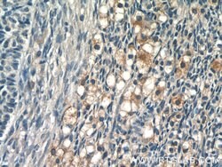 GLOD4 Rabbit anti-Human, Mouse, Rat, Polyclonal, Proteintech 150 &mu;L;
