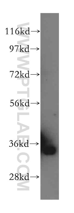 GLOD4 Rabbit anti-Human, Mouse, Rat, Polyclonal, Proteintech 150 &mu;L;