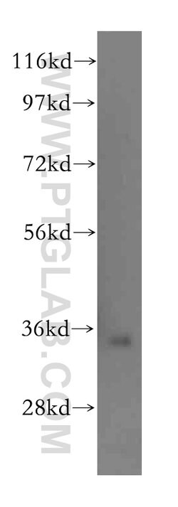 GLOD4 Rabbit anti-Human, Mouse, Rat, Polyclonal, Proteintech 150 &mu;L;