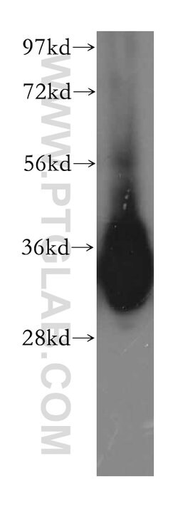 GLOD4 Rabbit anti-Human, Mouse, Rat, Polyclonal, Proteintech 150 &mu;L;