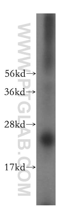 METTL5 Rabbit anti-Human, Mouse, Rat, Polyclonal, Proteintech:Antibodies:Primary