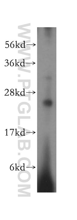METTL5 Rabbit anti-Human, Mouse, Rat, Polyclonal, Proteintech:Antibodies:Primary