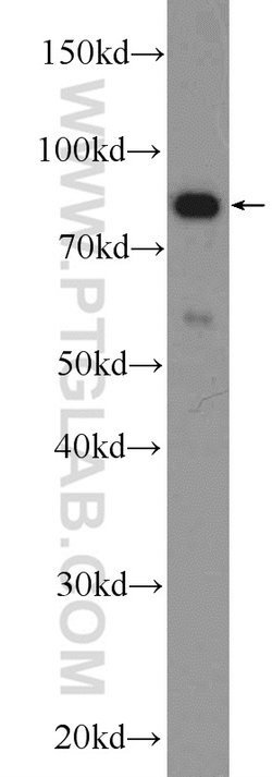 PLCD3 Rabbit anti-Human, Mouse, Rat, Polyclonal, Proteintech 150 &mu;L;