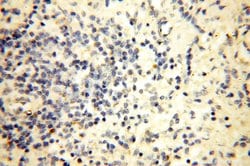 MRPL52 Rabbit anti-Human, Mouse, Rat, Polyclonal, Proteintech 150 &mu;L;