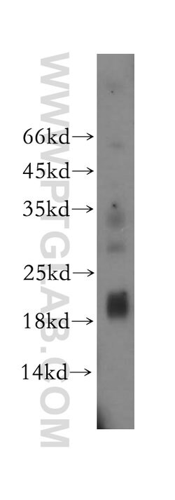 MRPL52 Rabbit anti-Human, Mouse, Rat, Polyclonal, Proteintech 150 &mu;L;
