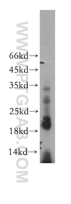 MRPL52 Rabbit anti-Human, Mouse, Rat, Polyclonal, Proteintech 150 &mu;L;