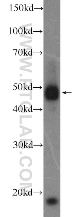RNF26 Rabbit anti-Human, Mouse, Rat, Polyclonal, Proteintech 150 &mu;L | Buy Online | Proteintech Group Inc | Fisher Scientific
