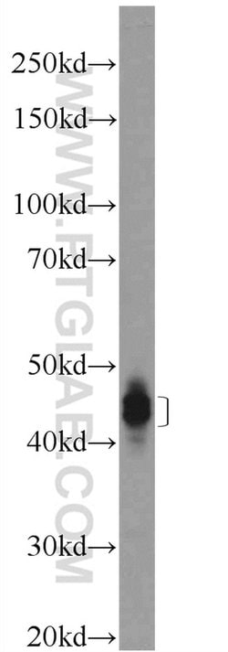 Dematin Rabbit anti-Human, Mouse, Rat, Polyclonal, Proteintech 150 &mu;L;