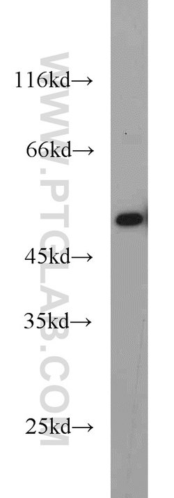 MAGED4 Rabbit anti-Human, Polyclonal, Proteintech:Antikörper:Primärantikörper