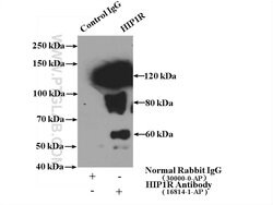 HIP1R Rabbit anti-Human, Mouse, Rat, Polyclonal, Proteintech 150 &mu;L;