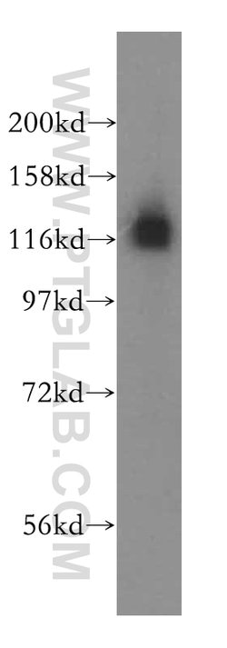 HIP1R Rabbit anti-Human, Mouse, Rat, Polyclonal, Proteintech 150 &mu;L;