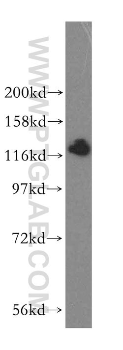 HIP1R Rabbit anti-Human, Mouse, Rat, Polyclonal, Proteintech 150 &mu;L;