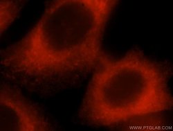 p130Cas Rabbit anti-Human, Mouse, Rat, Polyclonal, Proteintech 150 &mu;L;