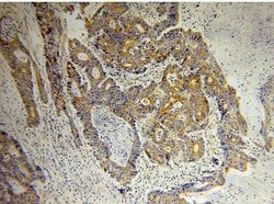 p130Cas Rabbit anti-Human, Mouse, Rat, Polyclonal, Proteintech 150 &mu;L;