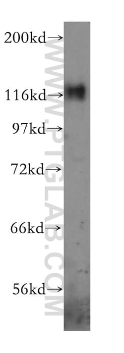p130Cas Rabbit anti-Human, Mouse, Rat, Polyclonal, Proteintech 150 &mu;L;