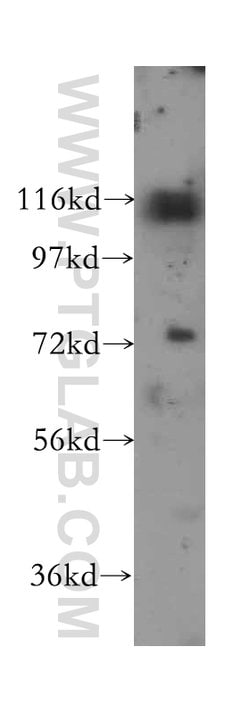 p130Cas Rabbit anti-Human, Mouse, Rat, Polyclonal, Proteintech 150 &mu;L;