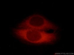 CC2D1A Rabbit anti-Human, Mouse, Rat, Polyclonal, Proteintech:Antibodies:Primary