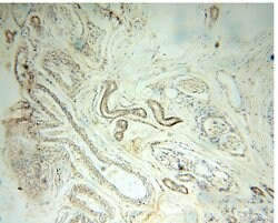 CC2D1A Rabbit anti-Human, Mouse, Rat, Polyclonal, Proteintech:Antibodies:Primary