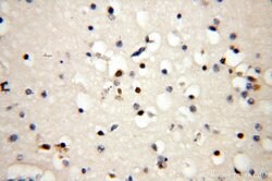 CC2D1A Rabbit anti-Human, Mouse, Rat, Polyclonal, Proteintech:Antibodies:Primary