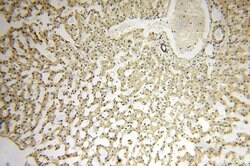 CC2D1A Rabbit anti-Human, Mouse, Rat, Polyclonal, Proteintech:Antibodies:Primary