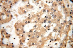 CC2D1A Rabbit anti-Human, Mouse, Rat, Polyclonal, Proteintech:Antibodies:Primary