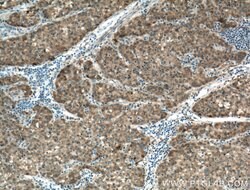 SPR Rabbit anti-Human, Mouse, Rat, Polyclonal, Proteintech 150 &mu;L; Unconjugated:Antibodies,