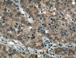 SPR Rabbit anti-Human, Mouse, Rat, Polyclonal, Proteintech 150 &mu;L; Unconjugated:Antibodies,