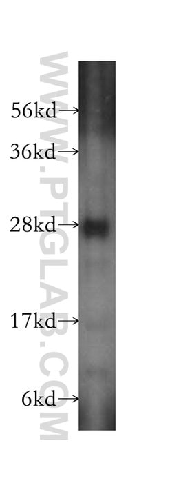 SPR Rabbit anti-Human, Mouse, Rat, Polyclonal, Proteintech 150 &mu;L; Unconjugated:Antibodies,