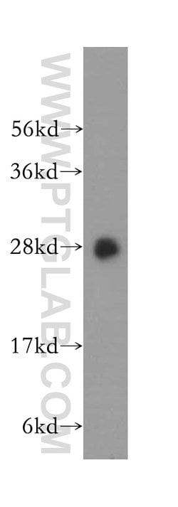 SPR Rabbit anti-Human, Mouse, Rat, Polyclonal, Proteintech 150 &mu;L; Unconjugated:Antibodies,