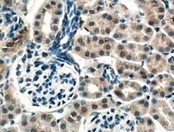 CNRIP1 Rabbit anti-Human, Mouse, Rat, Polyclonal, Proteintech:Antibodies:Primary