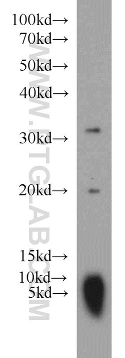 CNRIP1 Rabbit anti-Human, Mouse, Rat, Polyclonal, Proteintech:Antibodies:Primary