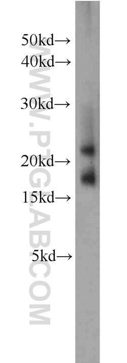 CNRIP1 Rabbit anti-Human, Mouse, Rat, Polyclonal, Proteintech:Antibodies:Primary