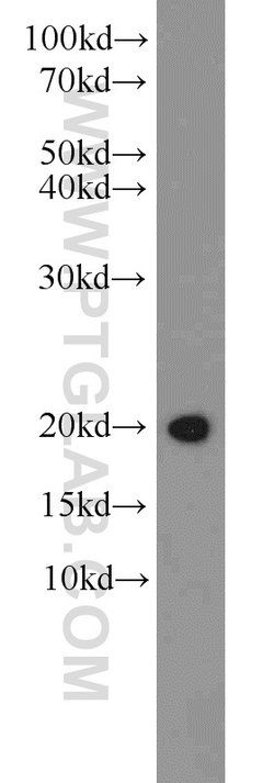 CNRIP1 Rabbit anti-Human, Mouse, Rat, Polyclonal, Proteintech:Antibodies:Primary