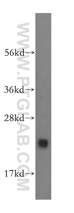CNRIP1 Rabbit anti-Human, Mouse, Rat, Polyclonal, Proteintech:Antibodies:Primary