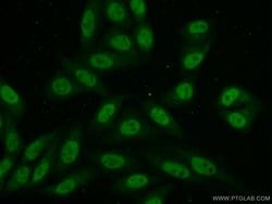 NCAPD3 Rabbit anti-Human, Polyclonal, Proteintech 150 &mu;L; Unconjugated:Antibodies,